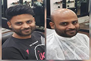 Hair Bonding Service